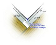 Protektor Nr.: 37323 Kompositprofil IS-300 für Kanten im Trockenbau Papierkaschiert, Stab für 90 Grad Innenecke